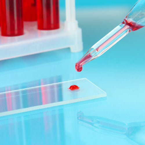 blood analysis