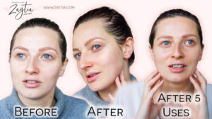Before and After for kiwifruit face mask