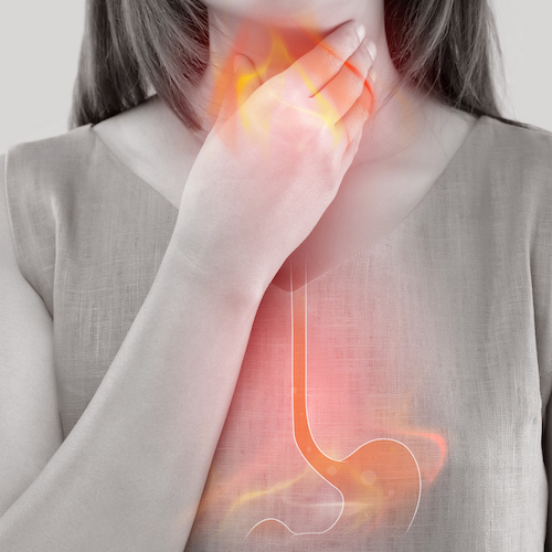 lady with heartburn or acid reflux